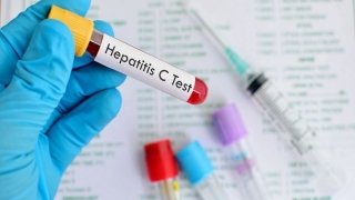 Ce se întâmplă cu programul cu interferon free pentru pacienţii cu hepatita C?